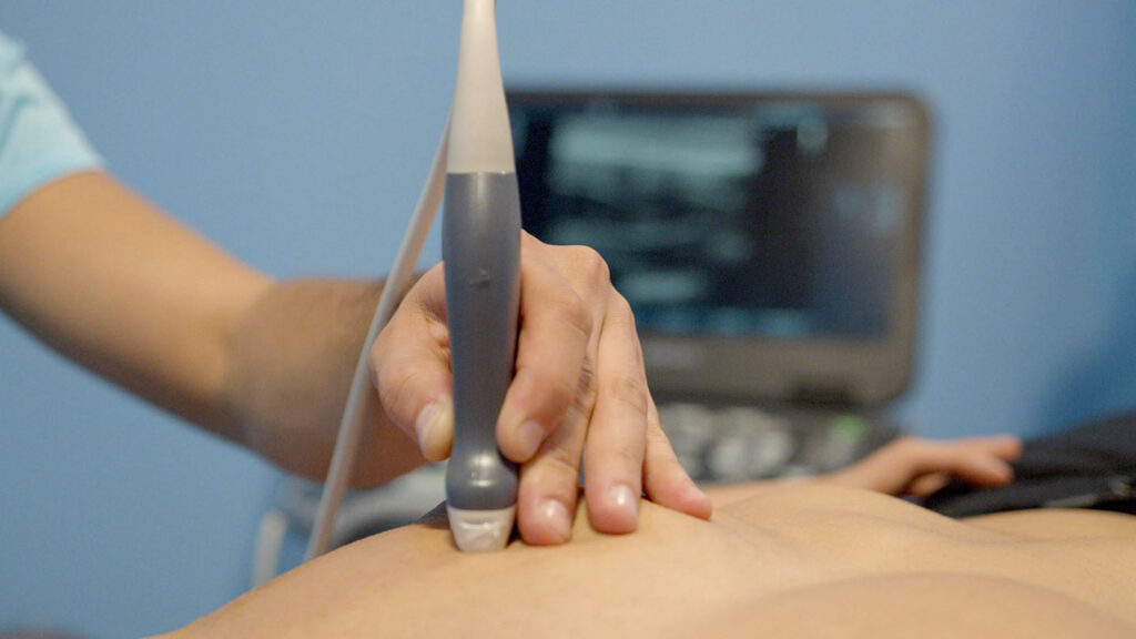 Ecografía musculoesquelética Madrid
