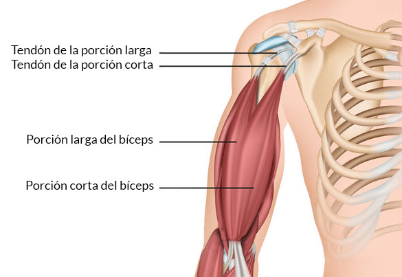 tendinitis hombro